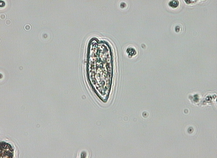 Dictyocha speculum